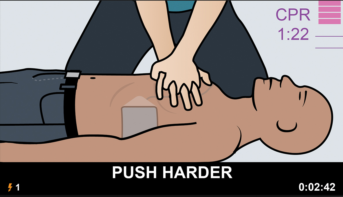 high quality cpr pauses in compression